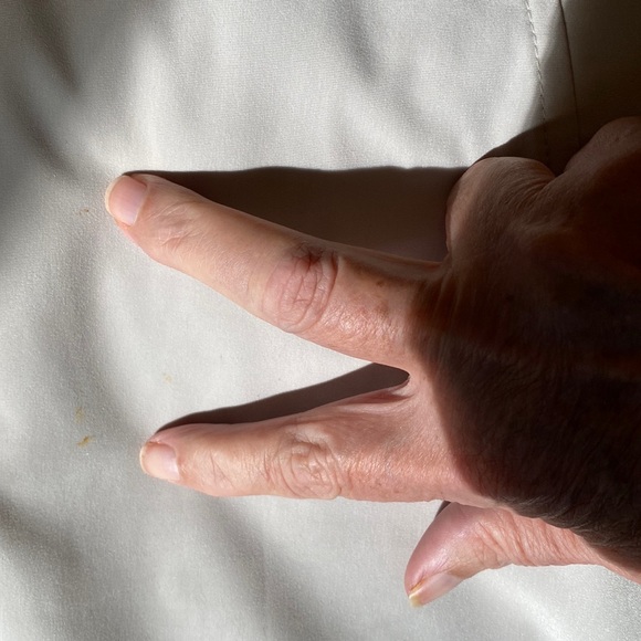 Reversible rain jacket - Picture 9 of 9